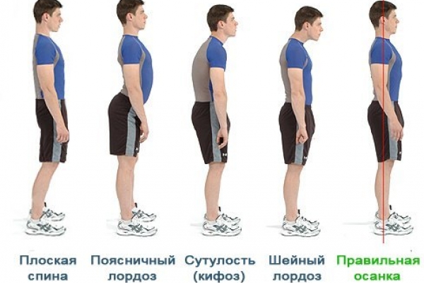 Исправляем осанку